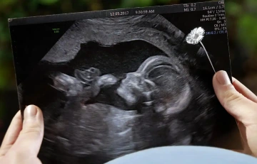 Těhotná žena se stříbrnou květinou a fotkou z ultrazvuku